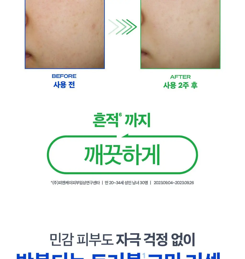[트러블 진정+모공 축소] 시카페인 트러블 리셋 세럼 상세페이지 21